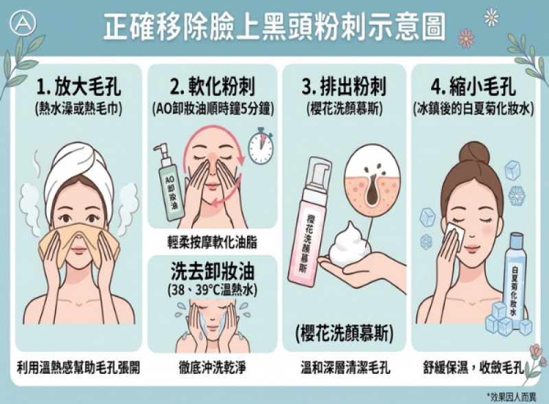 正確移除臉上黑頭粉刺示意圖